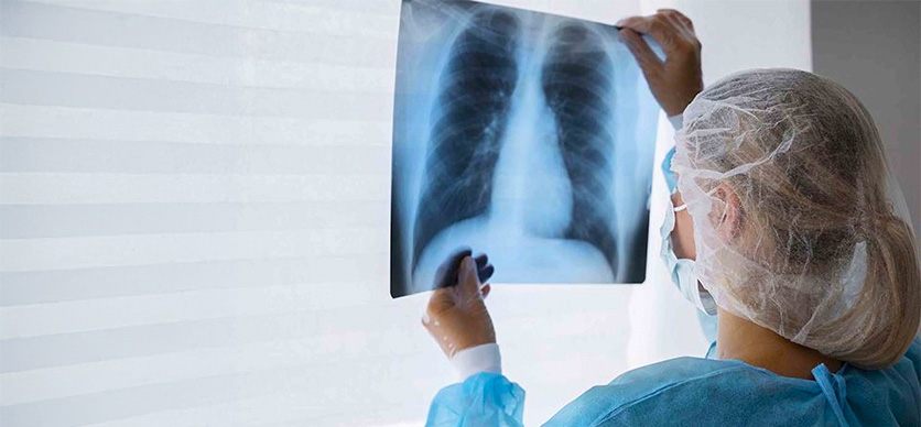 Programa vigilancia tuberculosis